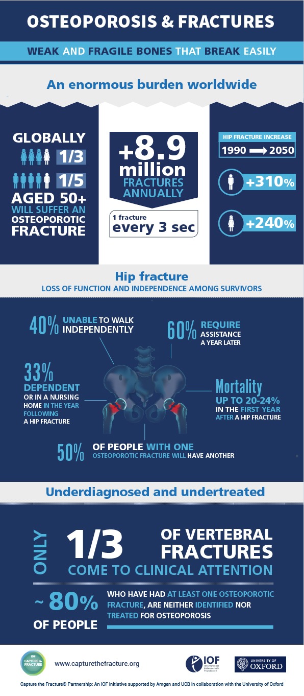 Despite its serious outcomes, osteoporosis remains vastly underdiagnosed and undertreated, particularly among individuals who have already broken a bone, and who are at high risk of suffering further fractures. The Capture the Fracture® Partnership aims to proactively implement post-fracture care coordination programs in hospitals and healthcare systems, to help prevent subsequent fractures due to osteoporosis, and improve patient care. Weiterer Text über ots und www.presseportal.ch/de/nr/100021616 / Die Verwendung dieses Bildes ist für redaktionelle Zwecke honorarfrei. Veröffentlichung bitte unter Quellenangabe: